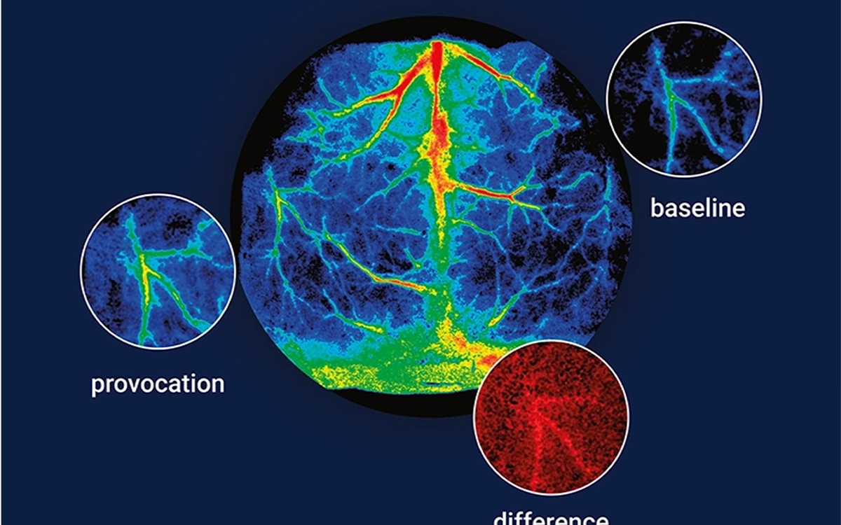 Blood perfusion imaging systems for vascular and clinical assessment in Egypt