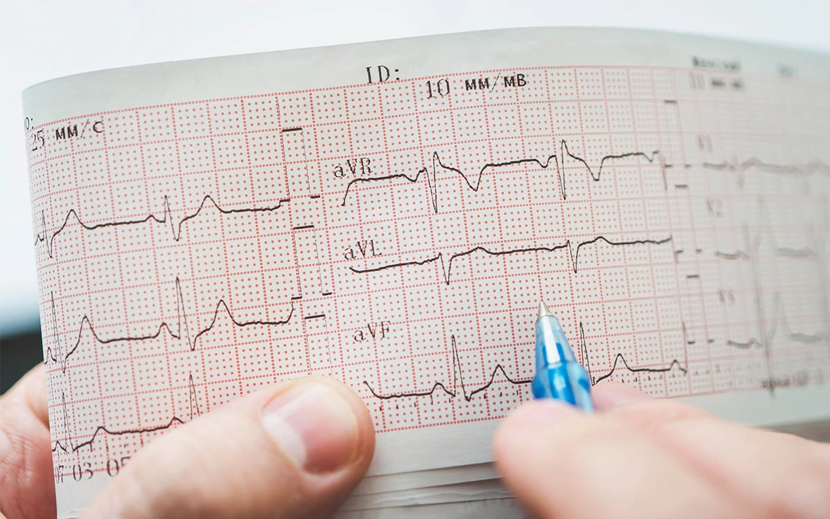 ECG systems for cardiac monitoring and patient assessment in Egypt