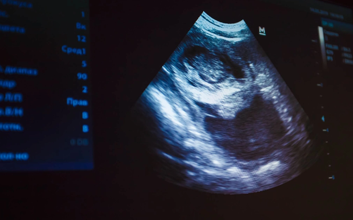 Ultrasound systems for medical imaging and clinical diagnosis in Egypt